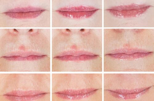 Best Lip Plumper – City Beauty City Lips Clear Review