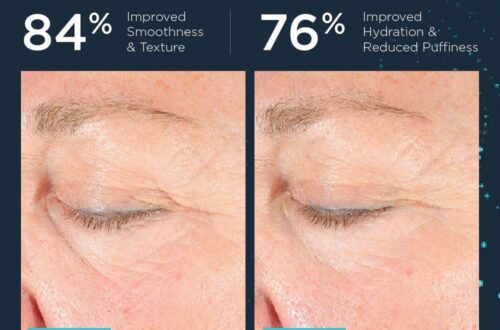 Best Eye Cream – NEOCUTIS Lumiere Firm Riche Review