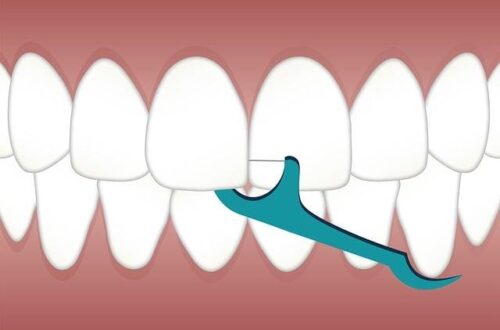 What Waterpik Is Best for Your Smile: Find the Perfect Water Flosser for Your Needs
