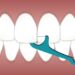 What Waterpik Is Best for Your Smile: Find the Perfect Water Flosser for Your Needs