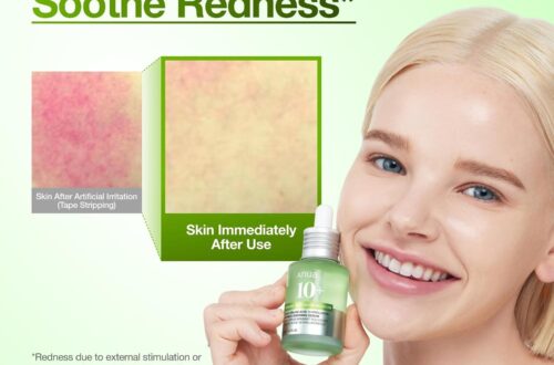 Best Serum for Blemish-Prone Skin – Anua Azelaic Acid 10 Hyaluron Review