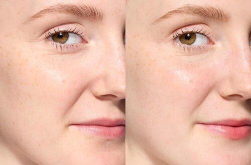 Best Sunscreen for Sensitive Skin – EltaMD UV Clear SPF Review